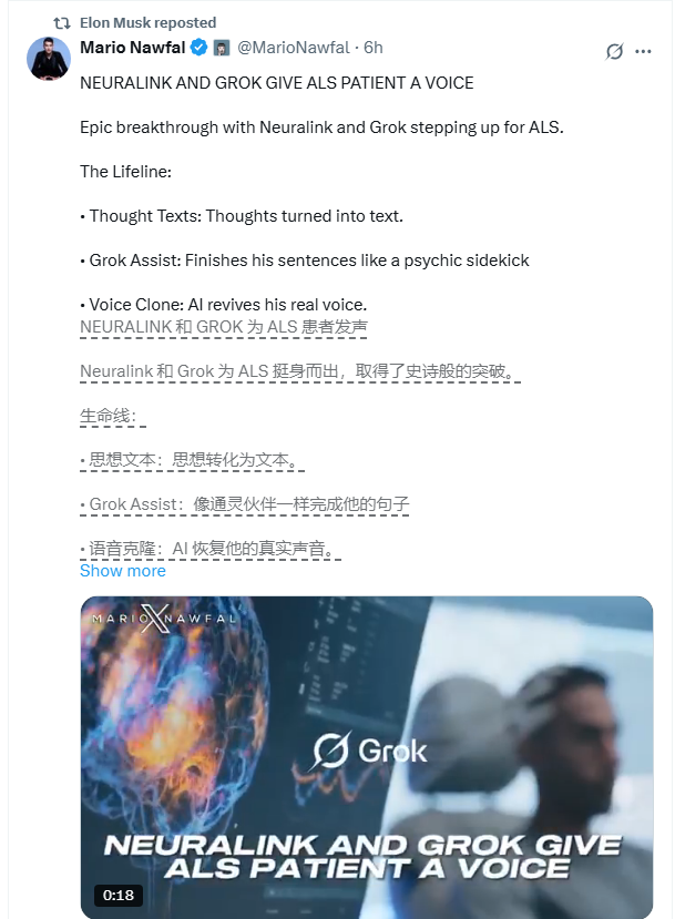 马斯克曝光突破性合作:Grok 与 Neuralink 联手助渐冻症患者开口说话